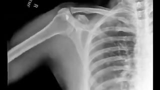 We look at the movements of people through an X-ray