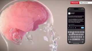 Elon Musk's Neuralink company implants brain chip in human for first time