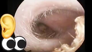 something strange in the ear