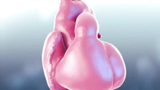 The Best Diet For Heart Disease (or Heart Attack) – Diet For Heart Patients – Dr. Berg