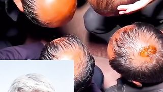 funny hair treatment