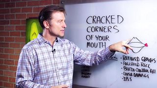 What Causes Cracked Corners of Mouth & How to Get Rid of Angular Cheilitis? – Dr. Berg