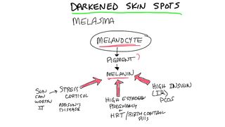 Darkened Skin Spots: 3 Causes of Dark Spots on Skin – Dr.Berg