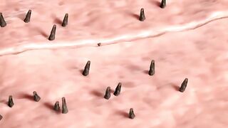 What is an INGROWN HAIR?  ????