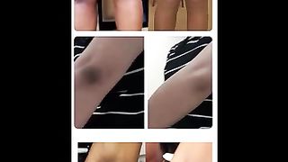 Simple cure for dark armpit