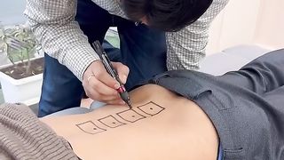 L4 - L5 दबी हुई नस का इलाज