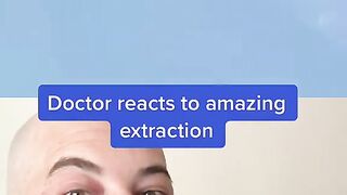Derm reacts to massive blackhead extraction! #dermreacts #doctorreacts #pimplepop #blackheads