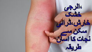 DRY ITCHING--  خشک خارش  کا  علاج
