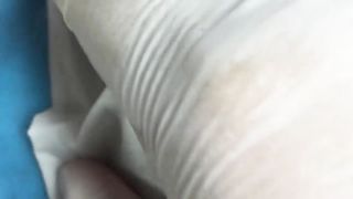 BEST Pimple Popping Big Cystic Acne Blackheads Whiteheads Removal Squeezing Pimples H046_720p - 012