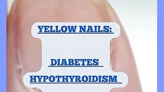 Check your nails ,Your nails disorders and diseases ,what do your nails says about your health