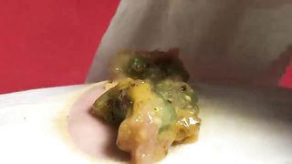 BEST Pimple Popping Big Cystic Acne Blackheads Whiteheads Removal Squeezing Pimples H051_720p - 012
