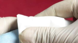 BEST Pimple Popping Big Cystic Acne Blackheads Whiteheads Removal Squeezing Pimples H052_720p - 009