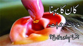Ear Discharge کان بہنا | Causes, Symptoms, Types, and Treatment | Urdu/Hindi