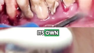 How to make your teeth become white faster