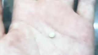 An insect lover has shown how his pets change