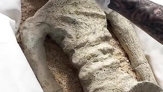 Autopsy of the body of an alien from Mexico