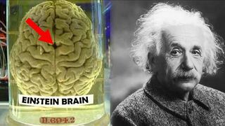 How Einstein's Brain was Different