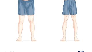 How to lose Belly fat Fast in One Week