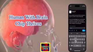 Elon Musk's Neuralink implants first brain chip in human
