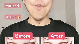 Reduced cheeks