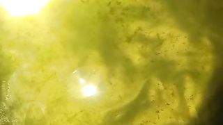 Keberhasilan di segmen pembenihan itu bukan hanya menetas telur jadi larva, tapi ngurus larva jadi bibit lele dewasa