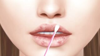 ASMR 피지 덩어리 폭발_ 입술 블랙헤드 압출하기 _ 입술 각질 관리하기 _ lip sebum _ blackhead extrusion animation(720P_HD)