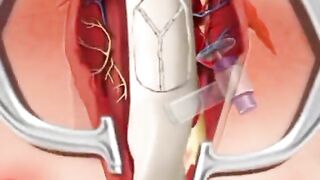 ASMR videos