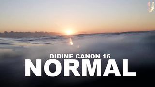 Normal