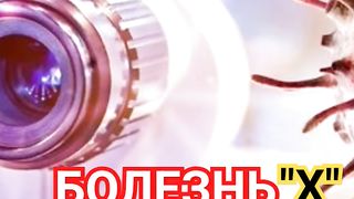 ВИРУС ИНФЕКЦИЯ ОПАСНЕЕ КОВИД БОЛЕЗНЬ Х