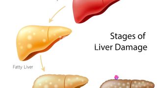Slim Down Naturally: Discover Live Pure Weight Loss Today!