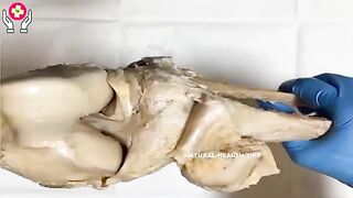 Bones weekness and joint pain complete tretment