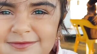 اغرب لون عيون ممكن تشوفه