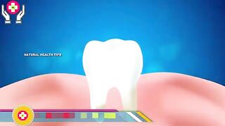 How to teeth whitening / 100% effectiv teeth home remedies