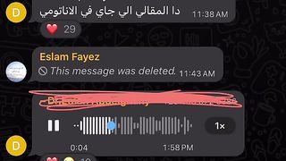 ضحك