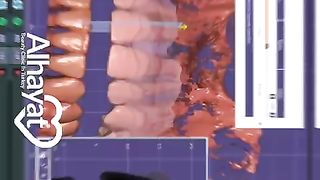 Digital Smile Design