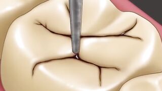 ASMR  animation for teeth