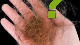 Common causes hair loss