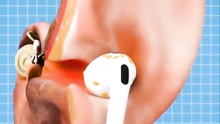 شاهد تأثير سماعات الاذن