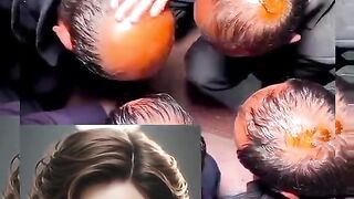 Hair growth