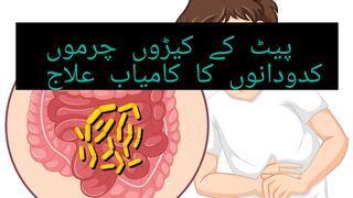 پیٹ کے کیڑوں ،چمونوں کدودانوں ،کرموں کا کامیاب علاج