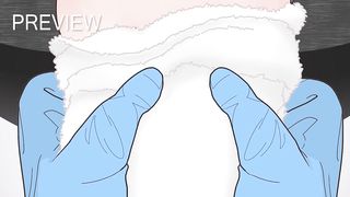 ASMR｜Ingrown Toenail and Corn removal treatment animation