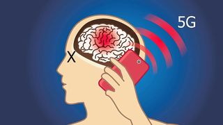 Is the 5G Radiation From Your Phone Killing You