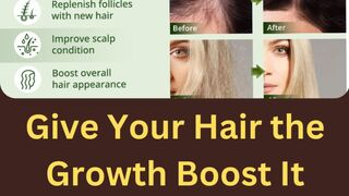 Amazon Finds: AIPILER Raw Batana Oil for Hair Growth