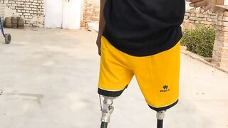 Orthotics and prosthetics Carrier video ????????