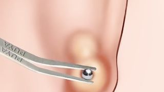 asmr 귀 염증치료하기.