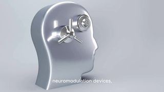 Neurostimulation implants for the treatment of migraines exploring treatment options