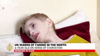Vulnerable children in northern Gaza face heightened starvation risk