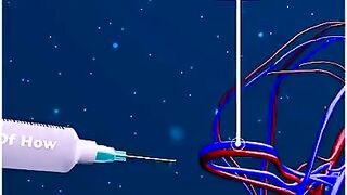 Why Vaccine on Arm is most effective? - By Kishor Singh #shorts