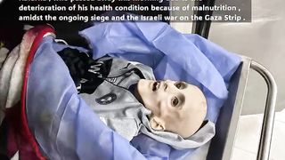 Starvation in Gaza