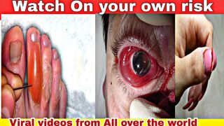 Watch on Your own risk